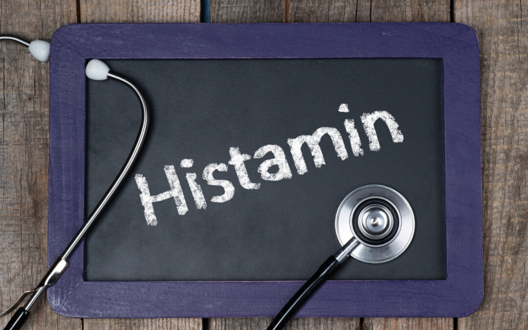 Histaminintoleranz Ursachen Vermeidung Unvertraeglichkeit ANWIMED